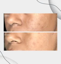 Powerbright Dark Spot Serum -Beauty Bakerie Shop 10069 powerbrightlaunchwebsite pdp images 7