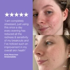 Dermalogica Stabilizing Repair Cream -Beauty Bakerie Shop 2060 stabilizing repair cream pdp quote