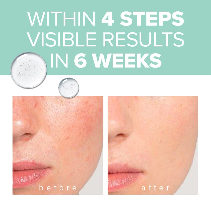 Native Come To Bed With Me | Skincare Set 4 Native Come To Bed With Me | Skincare Set - Image 2