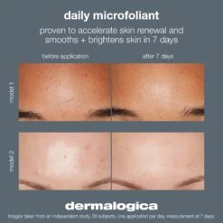 Dermalogica Smooth + Brighten: Daily Microfoliant (1 Travel Size) -Beauty Bakerie Shop DailyMicrofoliant7daysB A f939ad5f 5d8f 4005 8cb3 10766c80d516