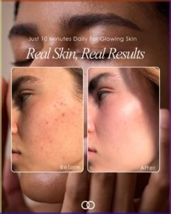 Native Essential Set - 5 Essential Skincare 20 Native Essential Set - 5 Essential Skincare -Beauty Bakerie Shop Join the Beauty Tech Movement LED Light Therapy Project E Beauty