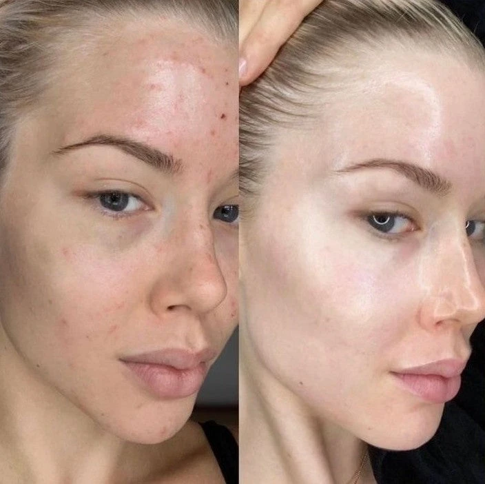 Native Essential Set - 5 Essential Skincare 10 Native Essential Set - 5 Essential Skincare - Image 9