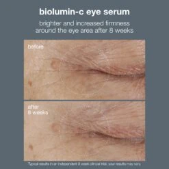 Dermalogica Biolumin-C Vitamin C Eye Serum -Beauty Bakerie Shop biolumin c eye serum ba