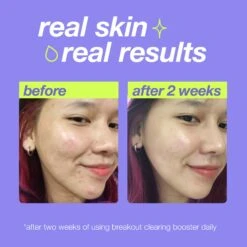 Dermalogica Breakout Clearing Booster 13 Dermalogica Breakout Clearing Booster -Beauty Bakerie Shop breakout clearing booster pdp 02