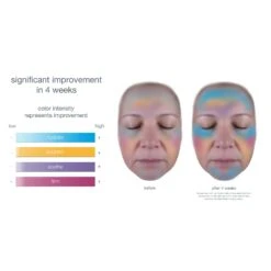 Smart Response Serum -Beauty Bakerie Shop clinical SRS image