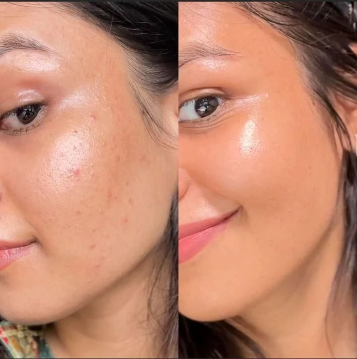 Native Essential Set - 5 Essential Skincare 12 Native Essential Set - 5 Essential Skincare - Image 11