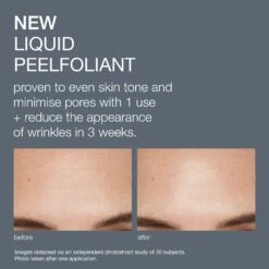 Dermalogica Liquid Peelfoliant -Beauty Bakerie Shop liquid peelfoliant pdp 6