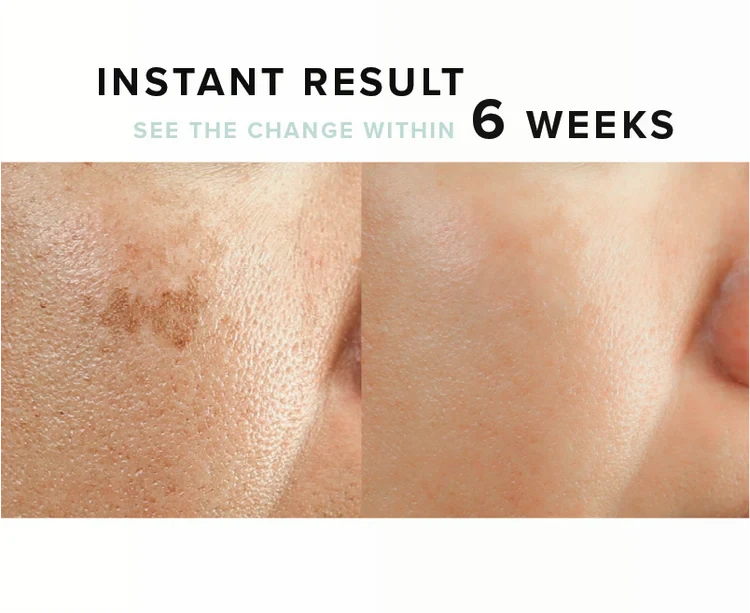 Native Come To Bed With Me | Skincare Set 9 Native Come To Bed With Me | Skincare Set - Image 7