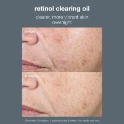 Dermalogica Retinol Clearing Oil -Beauty Bakerie Shop retinol clearing oil clinical